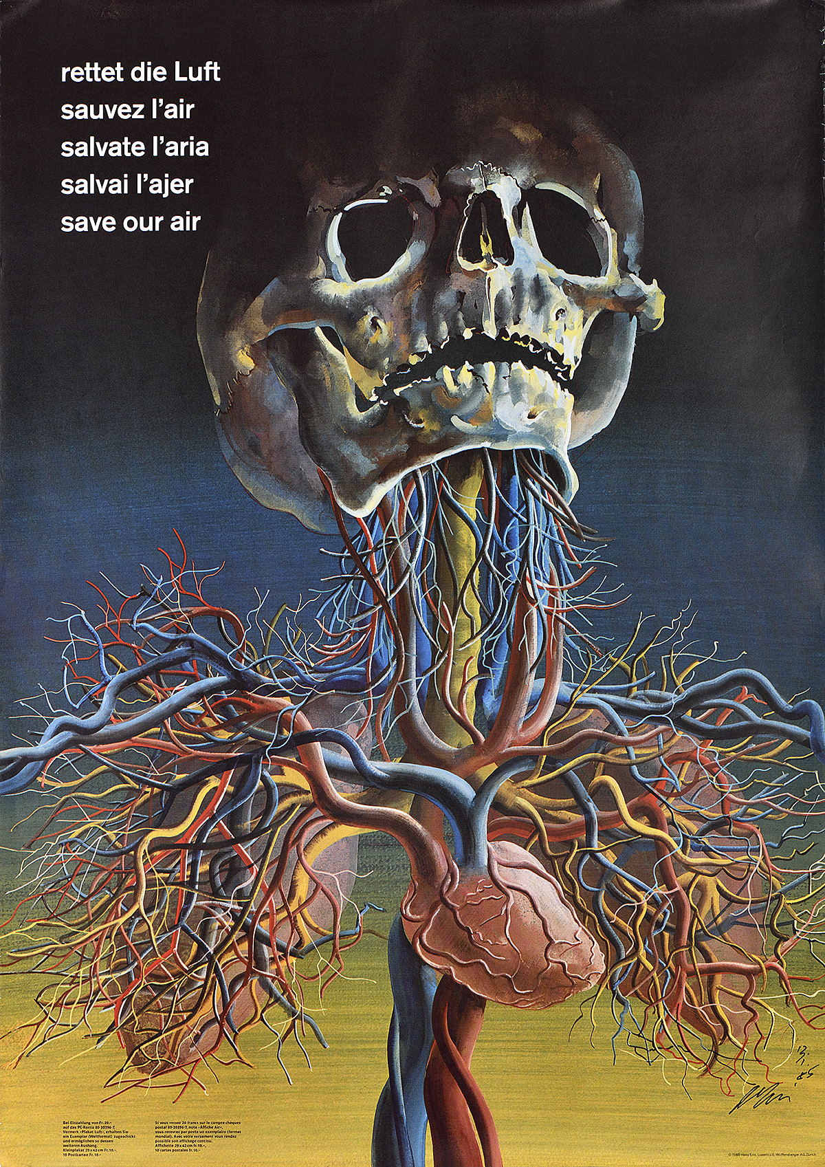 A poster of a skull with its arteries exposed against a blue and yellow background.